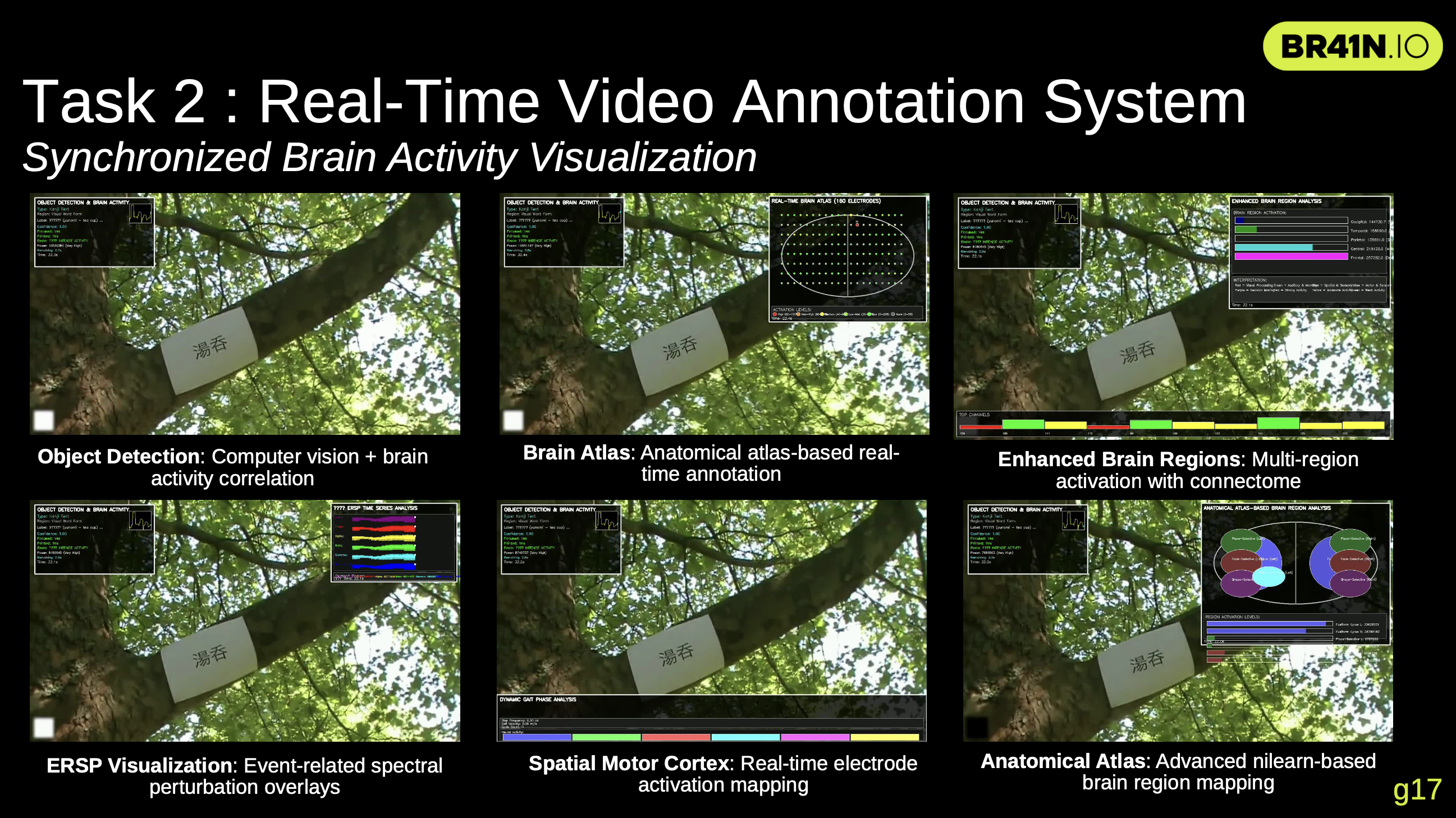 Brain Visualization Interface